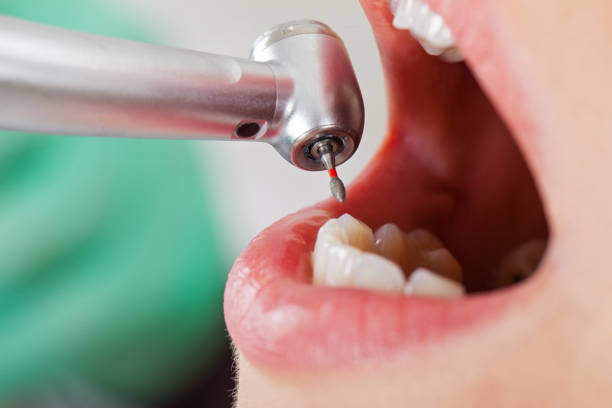 Best Emergency Dental Care for Sports Injuries in Crystal City, MO
